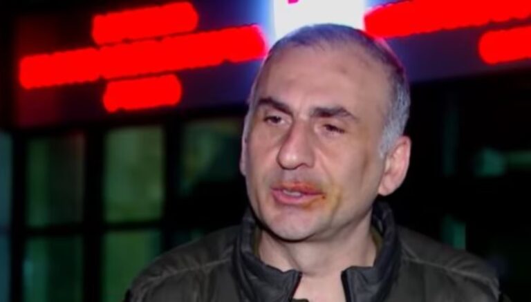 ერთი ნეკნი ჩამემტვრა, დანარჩენი ნეკნები მთელი მაქვს, ასე რომ, ბრძოლა წინაა-ალეკო ელისაშვილი