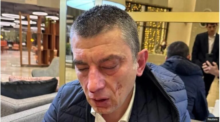 "ქართული ოპოზიციის ლიდერი, რომელიც სცემეს, მმართველ პარტიას ადანაშაულებს"-BBC